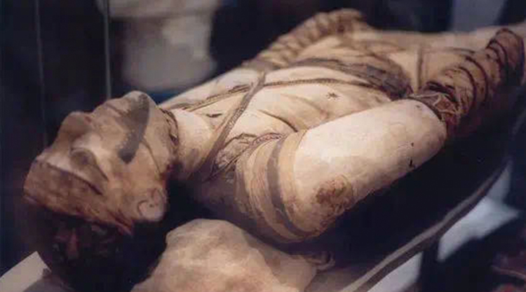 结核病在埃及木乃伊脊柱中发现